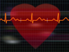 cardioversion