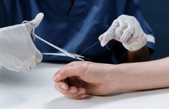 Quelles sont les meilleures pratiques pour une suture précise et efficace